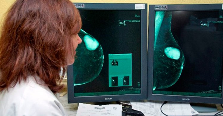 Veintitrés millones para realizar 575.000 mamografías en Talavera, Cuenca, Albacete y Ciudad Real