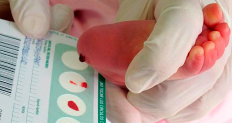 La prueba del talón diagnosticará hasta cuarenta posibles enfermedades en los recién nacidos en la región